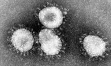 2019-nCoV: Wuhan novel Coronavirus, is this the one?