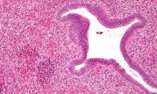 A Cure for COVID-19 Exists: Campaign to Debunk Its Effectiveness That Promotes Hazardous to Health Mass-Vaxxing